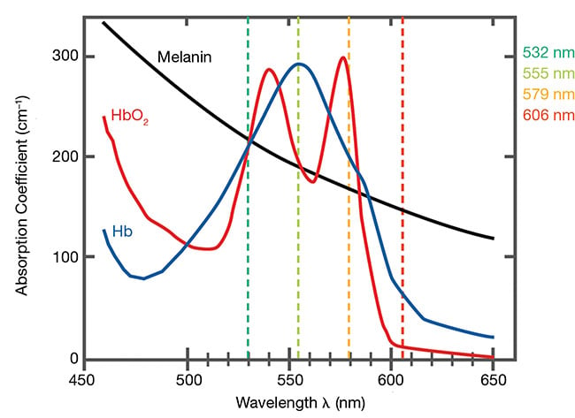 The absorption lines of typical skin and blood components. Absorption maxima with simultaneously reduced absorption of the other components occurs at 555 nm for deoxygenated hemoglobin (Hb), 579 nm for oxygenated hemoglobin (HbO2), and 606 nm for melanin. Courtesy of iThera Medical.