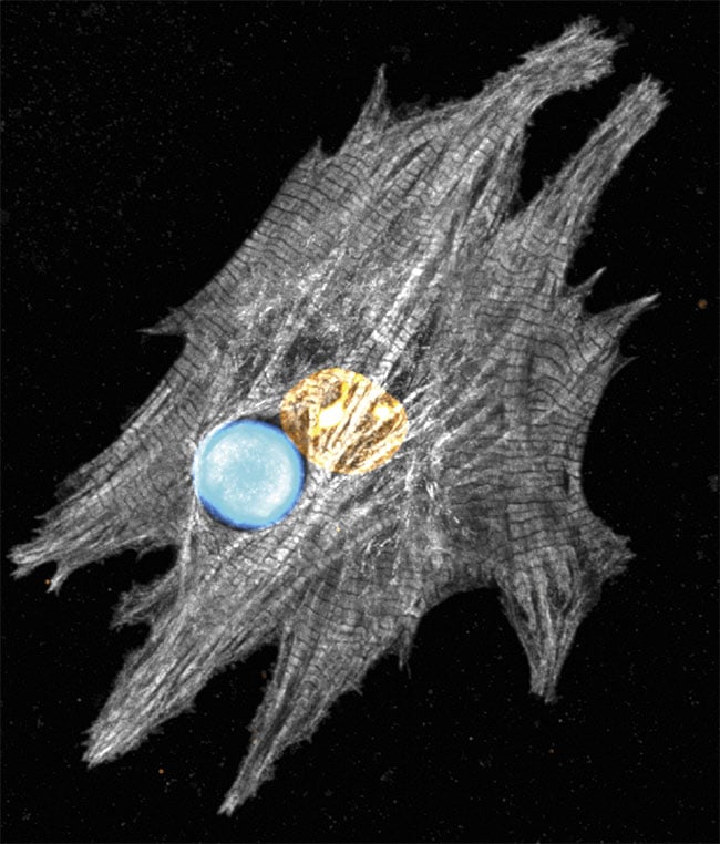 Confocal microscopy shows a microscopic laser that reveals the spectral details of a stained neonatal cardiomyocyte. Courtesy of the University of Cologne.