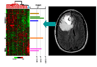 braintumor.jpg