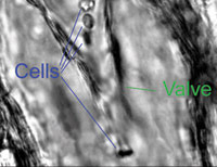 OptoFeat_Fig-2_Lymph-valve-new.jpg