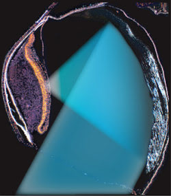 Postscripts_Diverticulum.jpg