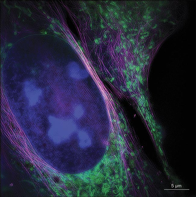 A three-color structured illumination micrograph (SIM) of a living bone cancer cell with nucleus (blue), mitochondria (green), and cytoskeleton (magenta). The image was acquired with a SIM system using instant image reconstruction. Courtesy of Andreas Marwirth/Bielefeld University.