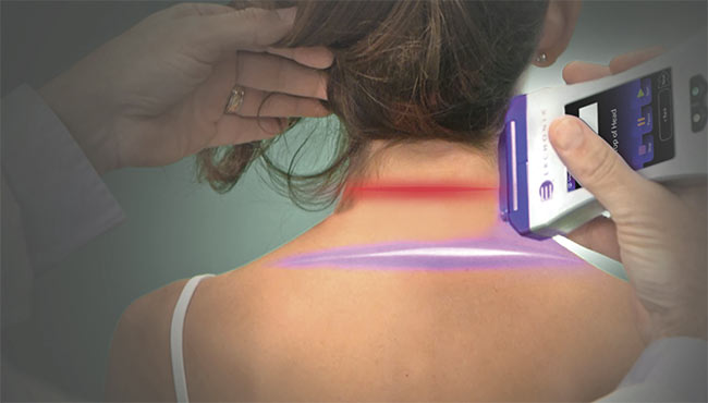While low-level laser therapies have generally relied on thermal effects in tissue as the basis for treatment, nonthermal technologies are beginning to gain traction. The first nonthermal laser therapy to receive FDA clearance for treating pain indication with a violet laser only emerged in 2019. The clearance allowed the use of 405-nm laser diode light to provide temporary relief of musculoskeletal-based chronic neck and shoulder pain. Courtesy of Erchonia.