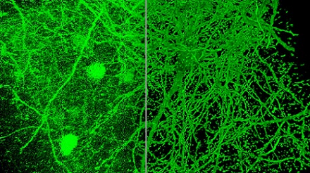 Left: original data imaged using a SP8 confocal microscope with a 40x 1.3 NA objective lens and resonant scanner in line average mode; Right: image restored using the 40x confocal AI deconvolution model from Aivia. Courtesy of Leica Microsystems.