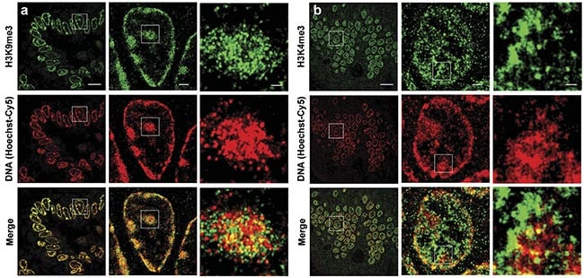 Figure 1. Two-color superresolution images of DNA and histone marks on mouse intestinal tissue. STORM images show the spatial relationship between DNA and the heterochromatin regions marked by H3K9me3 (histone 3 lysine 9 trimethylation) (a). STORM images show the spatial relationship between DNA and euchromatin regions marked by H3K4me3 (b). Scale bars: 10 µm, 1 µm, and 200 nm, respectively, in both the original and magnified images. Courtesy of the University of Pittsburgh.