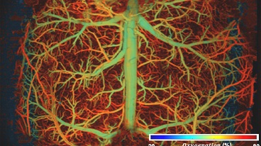 The vasculature of the brain, with the colors illuminating how capillaries experience varying levels of oxygenation as the brain undergoes hypoxia. Courtesy of Junjie Yao, Duke University. 