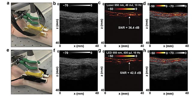 Figure 2. Comparison of LED- and laser-based photoacoustic in vivo vasculature imaging of the right-hand wrist of a healthy 25-year-old male human volunteer. The experimental setup, with the wrist placed inside a large water bath for laser-based photoacoustic imaging (a), and the images obtained via ultrasound (b), photoacoustic imaging (c), and co-registered ultrasound and photoacoustic imaging (d) for the setup shown in (a). The setup with LED arrays (e), and the images obtained via ultrasound (f), photoacoustic imaging (g), and co-registered ultrasound and photoacoustic imaging (h) for the setup shown in (e). SNR: signal-to-noise ratio. Adapted with permission from Reference 5.
