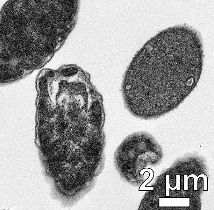 A transmission electron microscope image shows Escherichia coli bacteria in various stages of degradation after exposure to light-activated molecular drills developed at Rice University. The machines are able to drill into the membranes of antibiotic-resistant bacteria, killing them in minutes.  Courtesy of Matthew Meyer/Rice University.