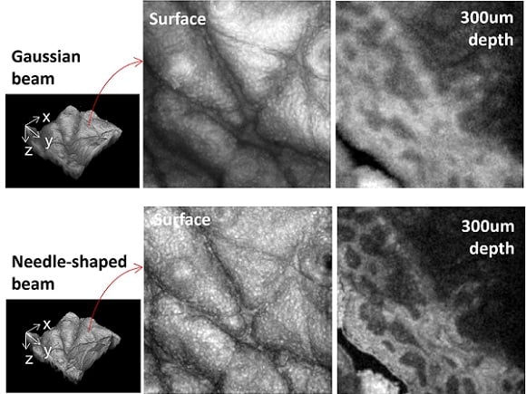 The researchers demonstrated their approach for generating needle-shaped beams by using a needle-shaped beam 300 microns long and 3 microns in diameter to perform OCT imaging of human skin. Their images showed much higher resolution (bottom) than OCT images using a traditional Gaussian-shaped beam. Courtesy of Jingjing Zhao, Stanford University School of Medicine.
