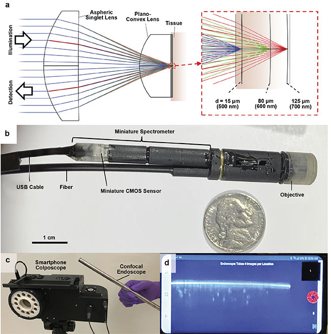 Figure 5. The working principle (top row) and photos (bottom rows) of the portable RCM endoscope. A custom miniature objective lens was used in the endoscope, which generated a large chromatic focal shift to image the tissue cross section over a depth range of 110 µm (a). The endoscope’s diameter is 9.5 mm, and the confocal image data obtained from its miniature spectrometer was transferred over a USB cable (b). A smartphone colposcope was used in conjunction with the endoscope (c). The smartphone acquired and displayed confocal images (d). Adapted with permission from Reference 8.