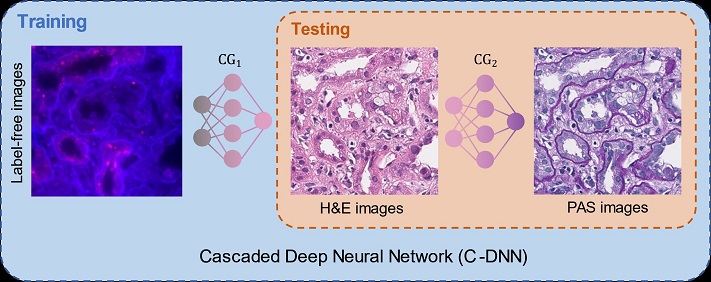 A virtual tissue re-staining method saves biopsied tissue for more advanced diagnostic tests to be performed, eliminating the need for a second, potentially unnecessary biopsy. The virtual tissue re-staining method could be applied to other types of stains used in histology, and the method for virtual stain transfer could lead to new opportunities in digital pathology and tissue-based diagnostics. This image depicts the virtual re-staining of tissue using cascaded deep neural networks. Courtesy of the Ozcan Lab at UCLA.