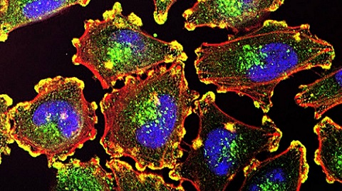 UMD researchers have successfully combined three photoimmunotherapy technologies to help prevent the spread and return of metastatic cancer, while minimizing side effects of treatment. Courtesy of the National Institutes of Health.