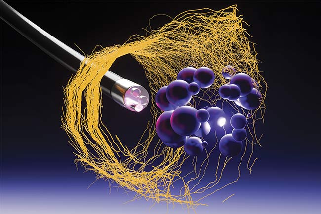 Figure 1. An illustration of an endoscope examining cells in the body. Courtesy of iStock.com/Yuuji.