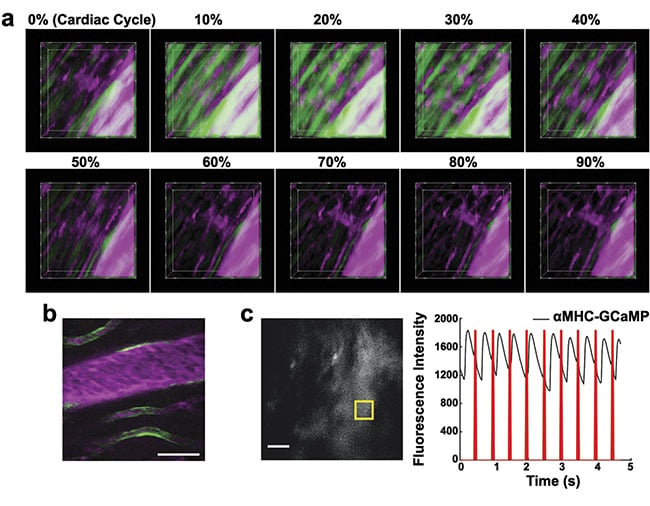 Figure 3. Genetically encoded proteins provide additional functional markers. Action potentials increase fluorescence of GCaMP in cardiomyocytes (a). GCaMP in endothelial cells (b). Optogenetic cardiac pacing by optical excitation of channelrhodopsin results in wide-field fluorescence changes in a mouse that expressed GCaMP in cardiomyocytes (c). Adapted with permission from Reference 6.