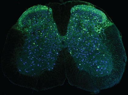 Neurons in the spinal cord (blue), including neurons that send signals about pain (green), are captured using one of the new, wearable microscopes. Courtesy of The Salk Institute.
