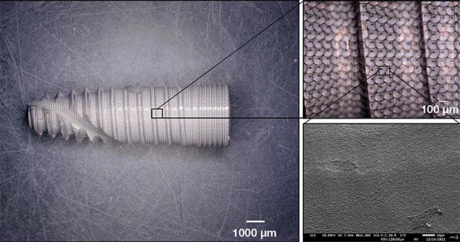 Figure 4. A dental implant textured with doughnut shapes for improved bone adhesion. Courtesy of Manutech.
