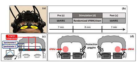 Noninvasive transcranial photobiomodulation (tPBM) experimental setup. (a): Placement of two pairs of optical probes on the forehead connected to a two-channel near-infrared spectroscopy (2-bbNIRS) unit to capture brain activity. (b): Test regimen followed for each participant. (c): Light source, two spectrometers, and probe bundles for 2-bbNIRS measurement. (d): Arrows indicating the right and left sites for tPBM and laser-protection goggles. Courtesy of Shahdadian et al., doi 10.1117/1.NPh.10.2.025012.