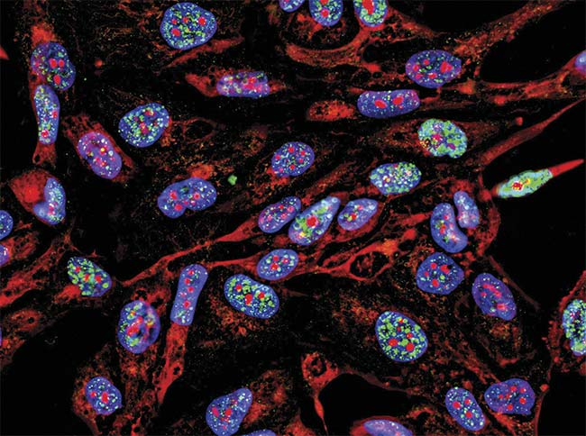 Figure 4. A uniform light source will generate accurate data representative of the sample, in this case, fluorescence imaging immunofluorescence of cancer cells growing in 2D with nuclei (blue), cytoplasm (red), and DNA damage foci (green). Courtesy of iStock.com/Nicola Ferrari.