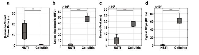 Figure 4. Indocyanine green (ICG) fluorescence metrics distinguish necrotizing soft-tissue infections (NSTIs) and non-NSTIs (i.e., cellulitis): signal-to-background (a) and dynamic contrast-enhanced fluorescence imaging first-pass kinetic curve parameters (b-d). RFU: relative fluorescence units. One-way analysis of variance results: *: P = 0.05; **: P = 0.01; ***: P = 0.001. Courtesy of Dartmouth Health.