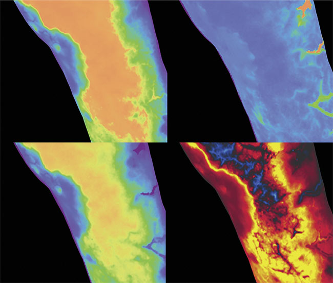 The panels in the image depict dynamic contrast-enhanced fluorescence imaging first-pass kinetic parameters derived from video-rate imaging of indocyanine green fluorescence, quantifying tissue perfusion in an infected limb. (Clockwise, from top left) Max intensity, time-to-peak, ingress slope, and egress slope. Courtesy of Dartmouth Health.