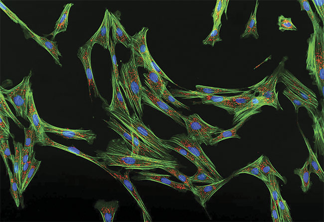 An image of fluorescent cell fibroblasts taken with the APX100 digital imaging system. Courtesy of Evident Scientific.