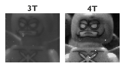 The image portrays a comparison in quality between the conventional "3T" image sensor and the imec researchers' "4T" pixel image sensor. The imec group monolithically hybridized a short-wave infrared (SWIR) colloidal quantum-dot photodetector with an indium-gallium-zinc oxide (IGZO)-based thin-film transistor into a PPD pixel. This array was subsequently processed on a CMOS readout circuit to form a superior thin-film SWIR image sensor. Courtesy of imec.   