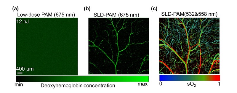 Image comparison of the in vivo results of (a): Low-dose PAM and (b): SLD-PAM, both at super-low pulse energy with a red-light source, and (c): oxygen saturation image acquired by SLD-PAM via dual-wavelength spectrum unmixing. Courtesy of Zhang, Y. et al., https://onlinelibrary.wiley.com/doi/10.1002/advs.202302486.