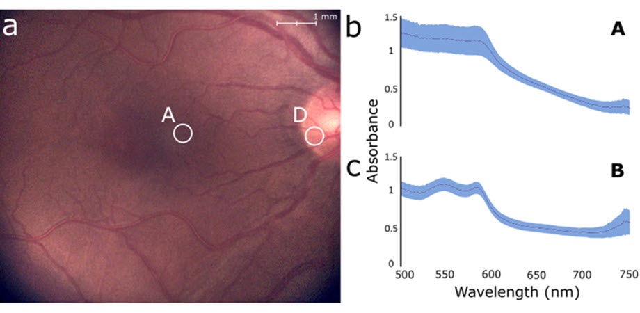 The targeted spectroscopy system can take detailed images of the eye fundus in real time, while simultaneously measuring the spectral profile of a small target region, whose position can be readjusted easily without requiring patient fixation. These capabilities make it easier to observe the spectral properties of specific structures or lesions in the retina, which can help in the diagnosis of various conditions. Courtesy of Lapointe et al., doi 10.1117/1.JBO.28.12.126004.