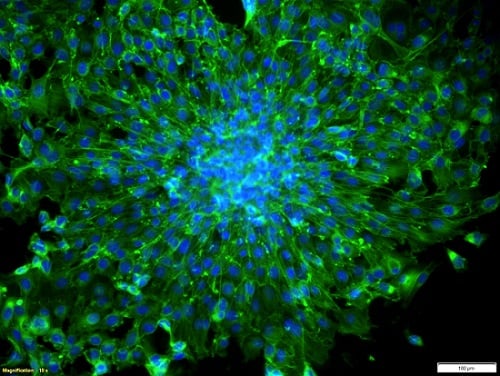 Actin-stained 3T3 fibroblast spheroid for LIFT transfer, cultivated in laser-fabricated microwells. Courtesy of Fraunhofer ILT, Aachen, Germany.