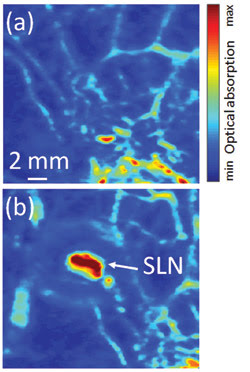 MDphotoai_SLN_PseudoColor.jpg