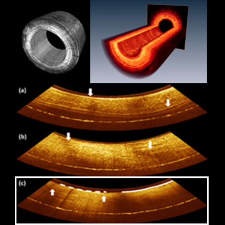 Endoscopic Optical Coherence Tomography