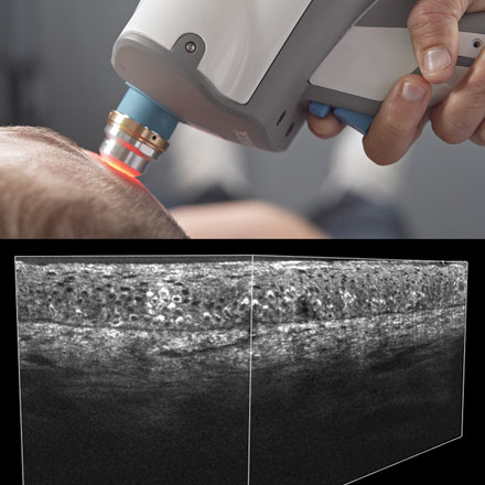 Line-Field Confocal Optical Coherence Tomography (LC-OCT): A New Tool for Noninvasive Cellular-Resolution Imaging of Human Skin