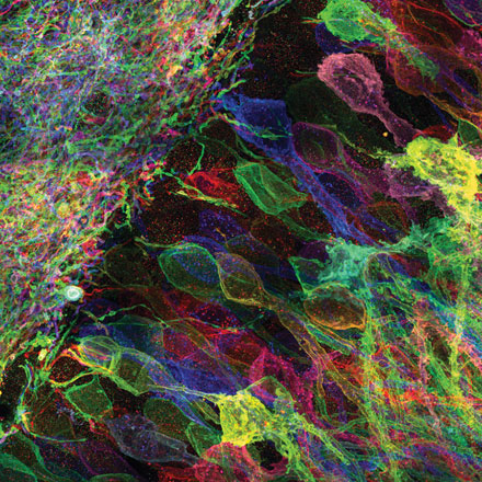 Optical Tools for Analyzing and Repairing Complex Biological Systems