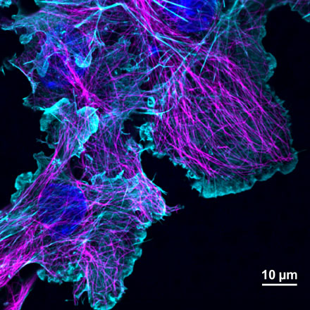Multi-Line Lasers or Laser Combiners: What Solution Is Best for Fluorescence Imaging?