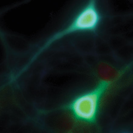 Advances in LED Illumination for Fluorescence Imaging