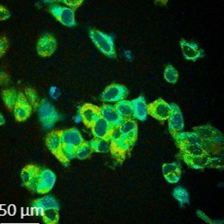 Fluorescence Lifetime Microscopy for Label-Free Imaging of Cellular Metabolism and Heterogeneity
