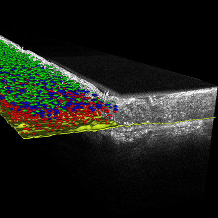 Technical Advancements in Line-Field Confocal Optical Coherence Tomography for Improving the Management of Skin Cancer