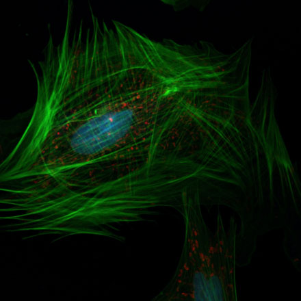Advancing and Extending the Spectral Range for Imaging in Fluorescence Microscopy