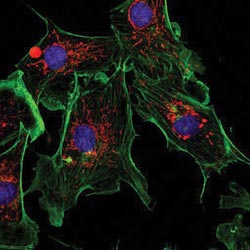 Lasers Play a Bigger Role in Biomedical Applications