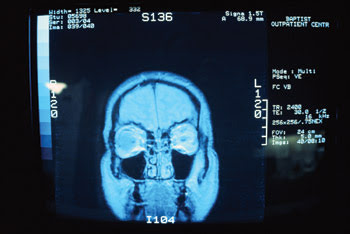 Digital Imaging from the Inside Out