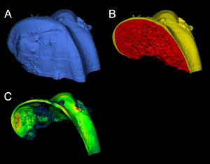 High-Res Scan Reveals Cartilage in 3-D