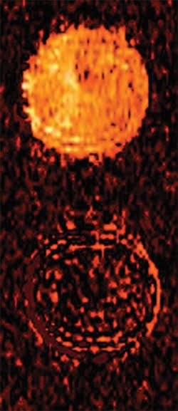 MRI-Fig-1_cas3_before_after_MRI.jpg
