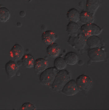 QDot_Fig-5_Pancreatic.jpg