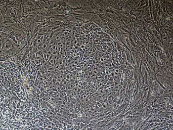 TSCRI_Fig-2_ESC-colony_CRES_cells.jpg