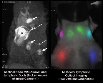 Small_Kobayashi-MRI-and-fluorescence.jpg