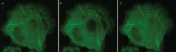 Making Live-Cell Imaging Glow