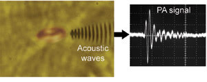 Photoacoustic Imaging Gets Dynamic