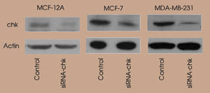 Functional Imaging & MRI