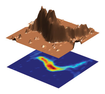 Magnetic Resonance Imaging Moves Ahead