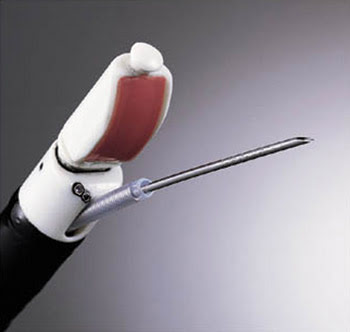 Getting a Better View from the Inside